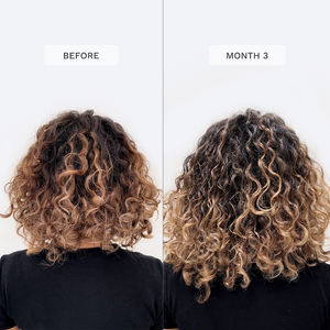 Vegán Hajnövesztő Gumivitamin 3 havi szett