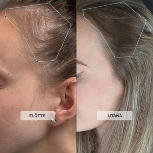 Hajvitamin Kismamáknak 3 Havi Szett