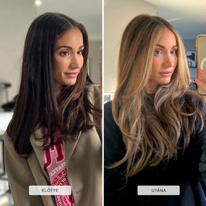 Hajnövesztő szett gumivitaminnal